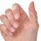 Best Natural Treatment for Trigger Thumb
