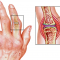 If you Live with Chronic Pain, we have a Solution!