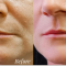 Tired of Costly Botox? Learn How Blue Scorpion Venom Benefits!