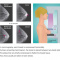 Breast Cancer Risk Factors: What is mammography?