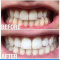Whitening Toothpaste