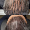 Scalp micropigmentation